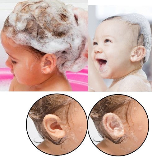 Su Gecirmez Yapiskanli Kulak Koruyucu Bant 10 lu Paket